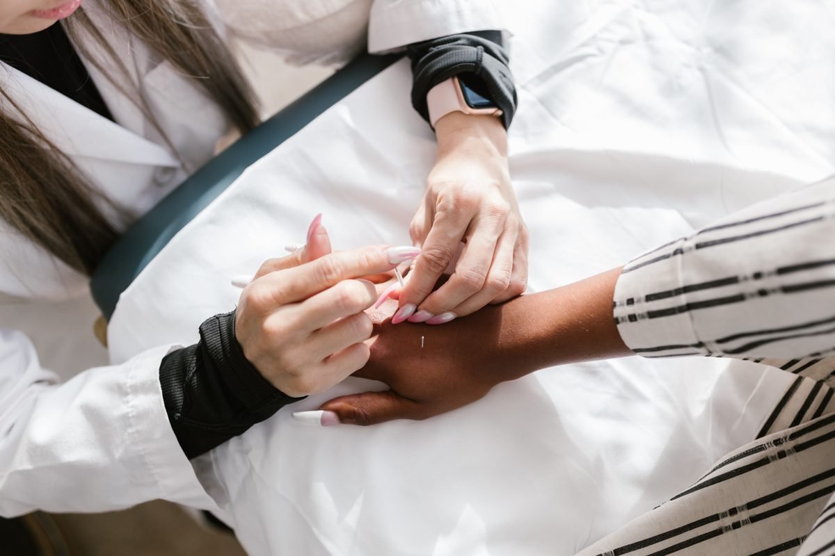 Acupuncture treatment being performed on a patient's hand
